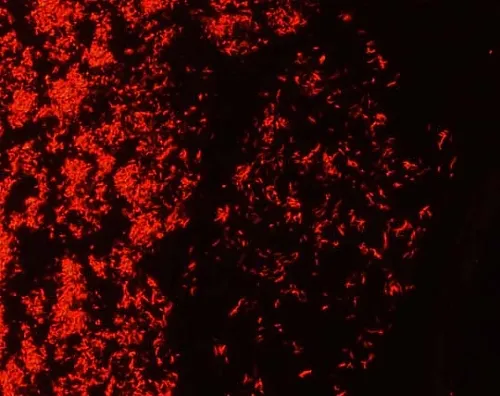 61-0290-26 Tb-Fluor Phenol Free Acid-Fast Bacteria Fluorescence Staining Kit (Auramin-Rhodamine Staining) 101597 1Set 1.01597.0001
