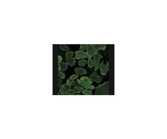 62-8496-19 Anti-MDR1, extracellular human specific Pgp, clone MM4.17; 100 μg MAB4162