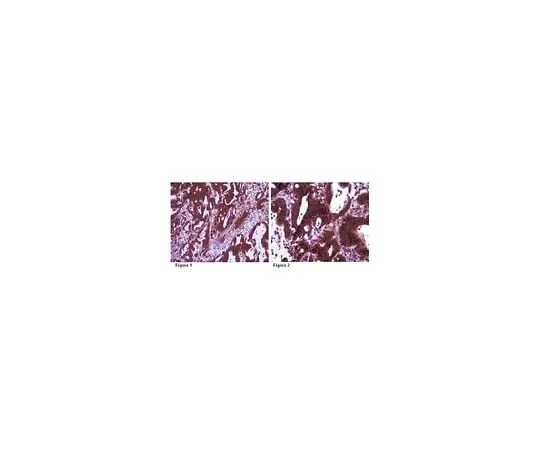 62-8472-48 Anti-INF2; 100 μg ABT61