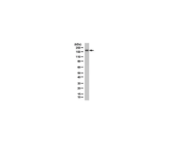 62-8468-49 Anti-TIAM-1 ABN1488