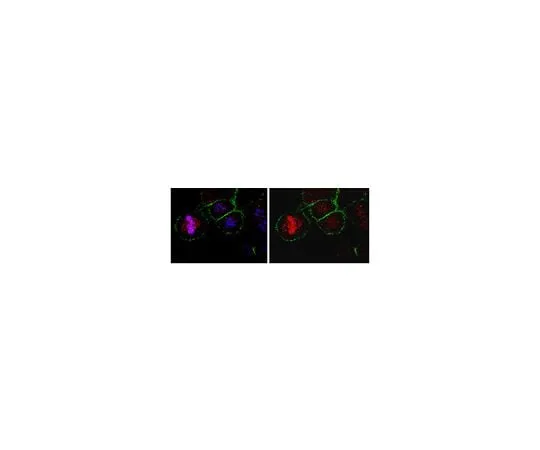 62-8472-21 Anti-CKAP5; 100 μL ABT10