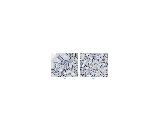 62-8518-05 Anti-Co-Rest/RCOR1 Antibody, clone K72/8 , Cat. No. MABN486 MABN486