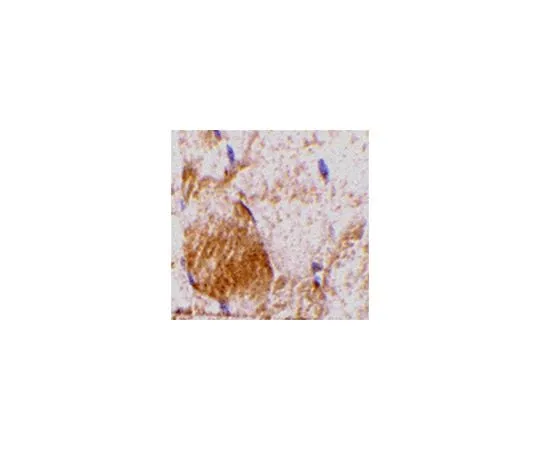 62-8470-17 Anti-IL-31 ABS455