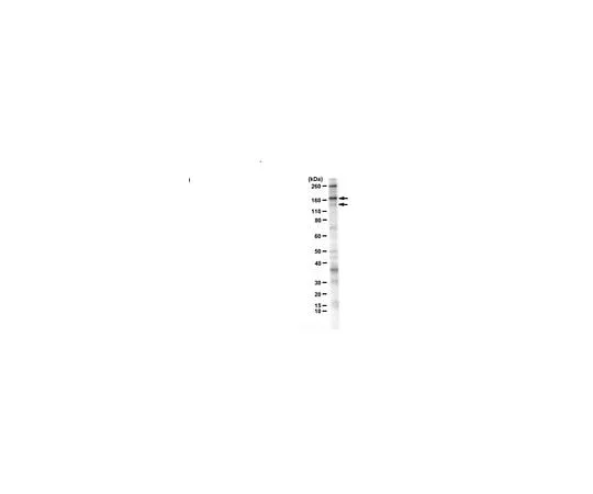 62-8468-73 Anti-RPGRIP1 ABN1700