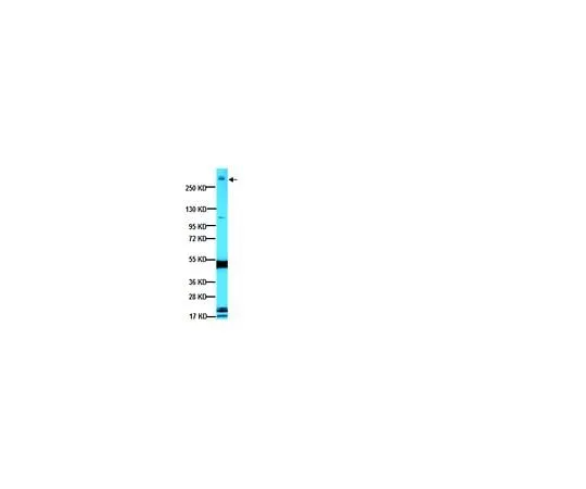 62-8489-22 Anti-MAP2A, 2B; 100 μL MAB378