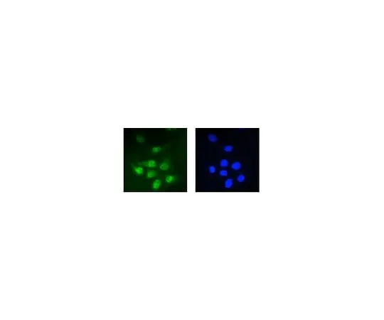 62-8522-28 Anti-PP2A reg. subunit B56 epsilon (PPP2R5E), clone 5A5-1F3 MABS270