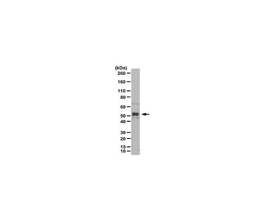 62-8471-63 Anti-phospho NF-kB p52, (Ser222) ABS1515