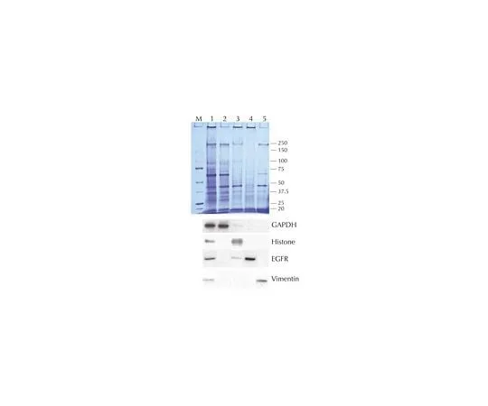 62-8534-56 Compartment Protein Extraction Kit; 1 kit 2145