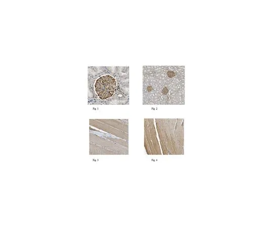 62-8525-76 Anti-Parvin alpha, clone 7E2.1 MABT157