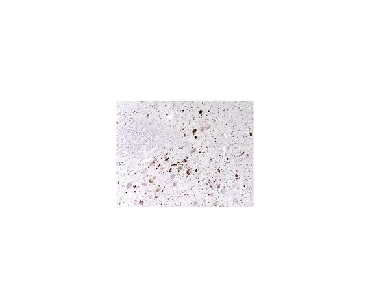 62-8517-70 Anti-Aggregated a-Synuclein, clone 5G4 MABN389