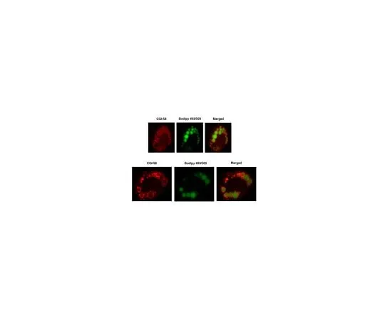62-8471-79 Anti-CGI-58 Antibody ABS1616