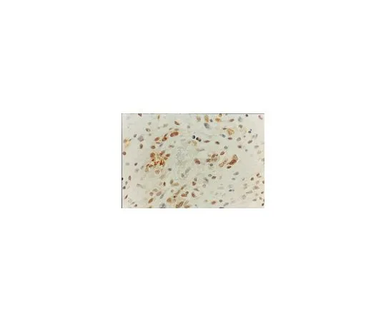 62-8500-43 Anti-MGMT, clone MT3.1; 100 μg MAB16200