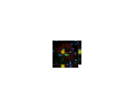 62-8519-60 Anti-Amyloid Beta 3NTyr10 Antibody, clone 4A5E8 MABN779