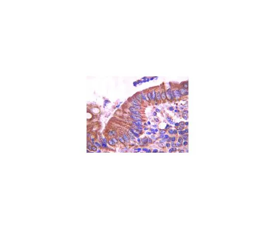 62-8525-19 Anti-E-cadherin, clone DECMA-1; 100 μg MABT26