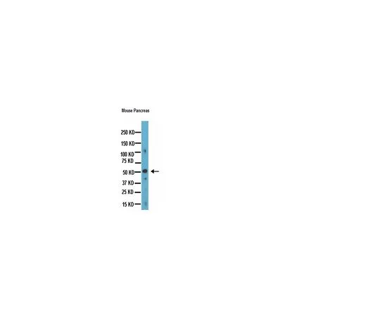 62-8497-37 Anti-Chromogranin A, clone LK2H10; 500 μg MAB5268