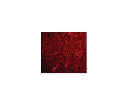 62-8471-08 Anti-GPAT-1 ABS764