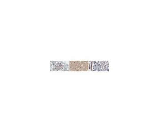 62-8474-11 Anti-MCAM/CD146 Antibody ABT1488