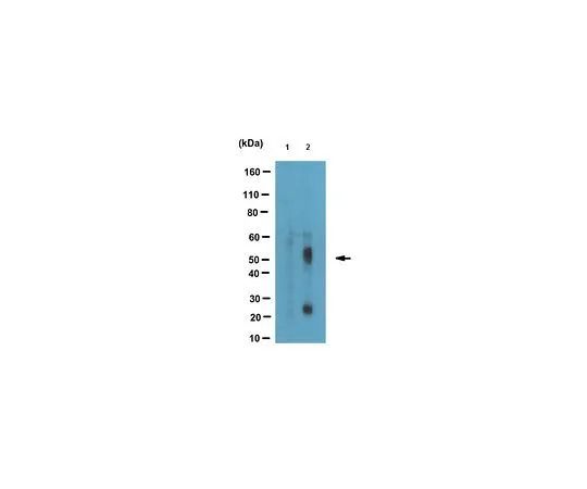 62-8517-69 Anti-phospho Tau (Thr181), clone 1E7 MABN388