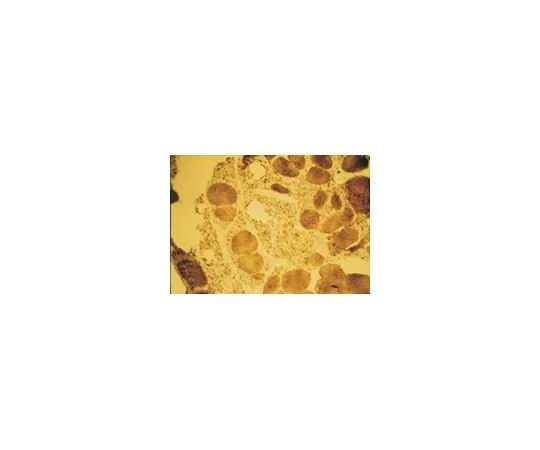 62-8491-62 Anti-Myosin, slow muscle, clone NOQ7.5.4D; 100 μg MAB1628