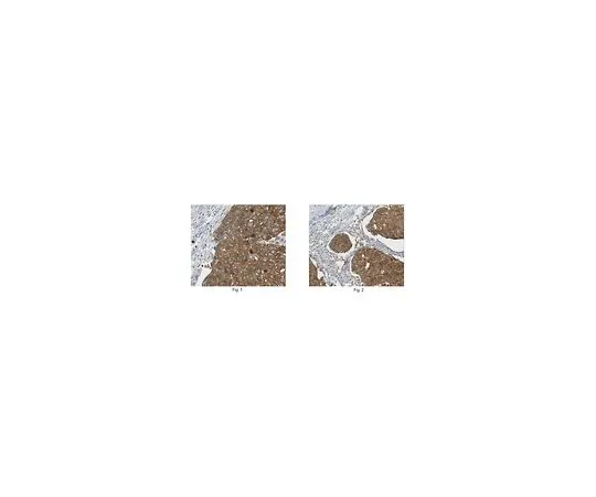 62-8501-45 Anti-Hyaluronan synthase 2 Antibody, clone 2B11.1 Cat. No. MABC151 MABC151