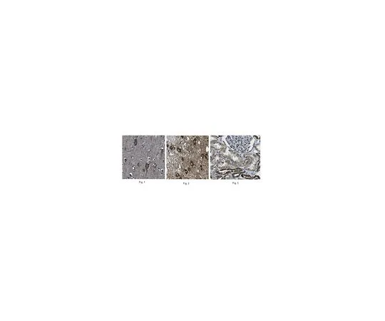 62-8520-09 Anti-(human) ABCA1, clone MABI98-7 MABN893