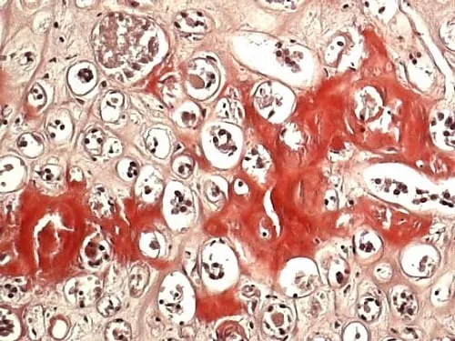 61-0290-31 Congo Red Staining Kit Amyloid Staining Kit (Highman Method) 101641 1Set 1.01641.0001