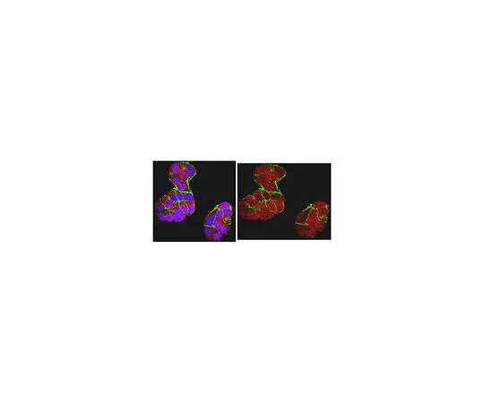 62-8501-73 Anti-BRCA1, clone MS110 MABC199