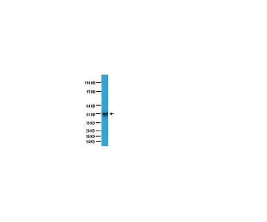 62-8494-71 Anti-Glial Fibrillary Acidic Protein, clone GA5; 40 μg MAB3402