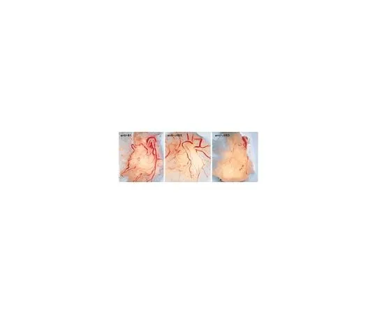 62-8492-63 Anti-Integrin alphaVbeta3, clone LM609; 100 μg MAB1976