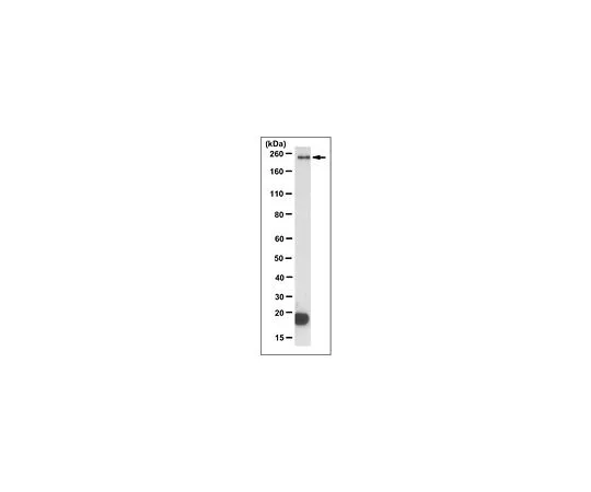 62-8503-51 Anti-Dysferlin/DYSF Antibody, clone 10H3.1 MABC974