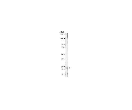 62-8522-24 Anti-c-K-Ras, clone 234-4.2; 100 μL MABS194