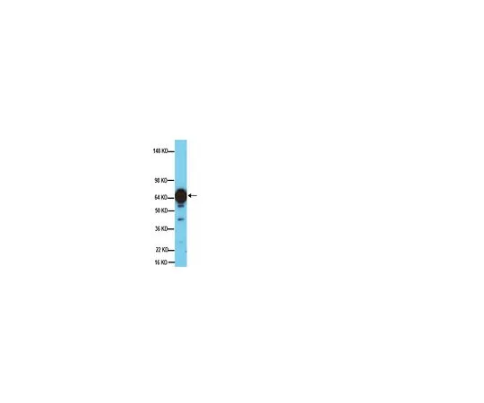 62-8497-43 Anti-Tyrosine Hydroxylase, clone 2/40/15; 40 μg MAB5280