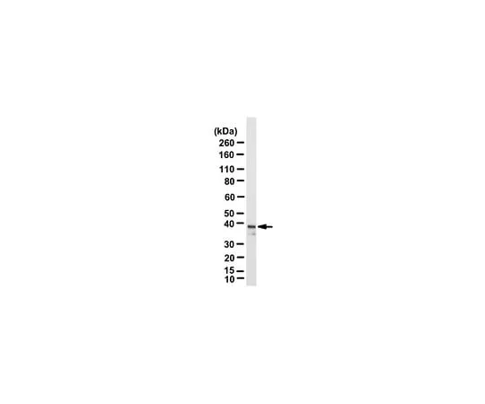 62-8469-71 Anti-YVH1; 100 μL ABS224