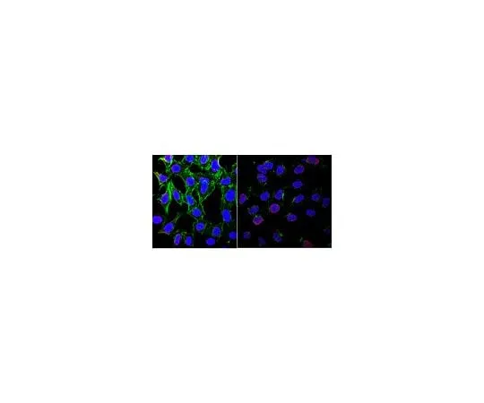 62-8495-71 Anti-phospho-ATM (Ser1981) Antibody, clone 10H11.E12, Ascites Free MAB3806-C