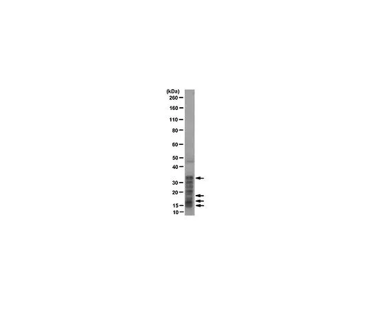 62-8504-97 Anti-Histone, H1 + core proteins, clone F152.C25.WJJ; 100 μg MABE71