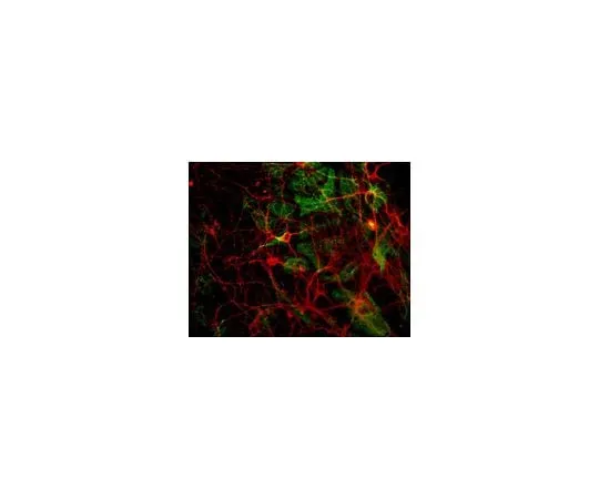62-8491-64 Anti-Tubulin, beta III isoform, C-terminus, clone TU-20 (Similar to TUJ1); 100 μL MAB1637