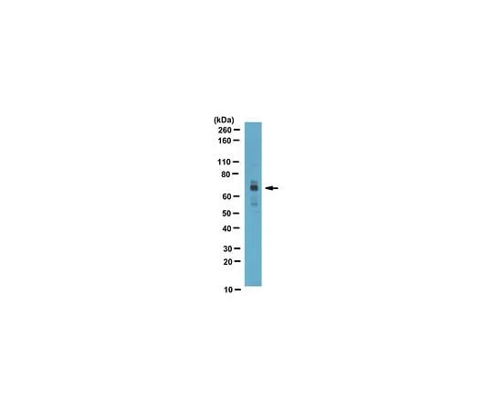 62-8469-29 Anti-CPT2 ABS85