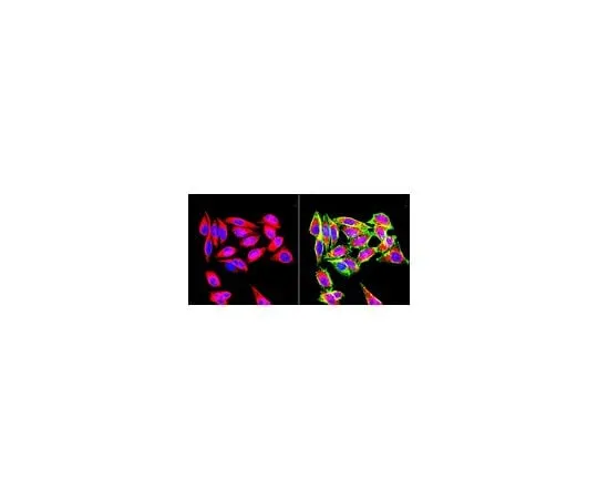 62-8479-44 Anti-Vimentin, clone VIM 3B4; 50 μg CBL202