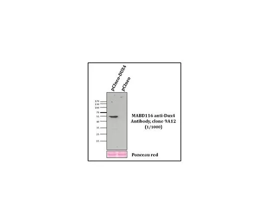 62-8504-47 Anti-Dux4, clone 9A12 MABD116