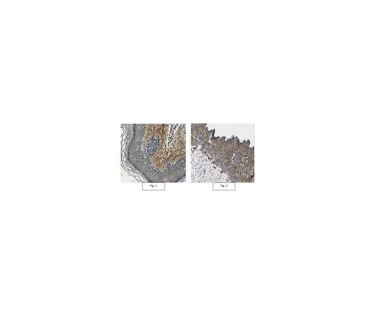 62-8473-42 Anti-Pro-Decorin Antibody ABT275