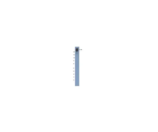 62-8498-49 Anti-Plectin, Clone 10F6; 100 μg MAB5674