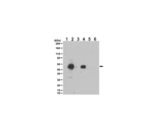 62-8473-98 Anti-phospho-Keratin-8 Antibody (Ser23) ABT1372
