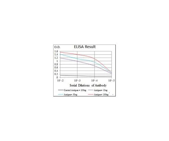 62-8502-84 Anti-ACLY, clone 5F8D11 MABC697
