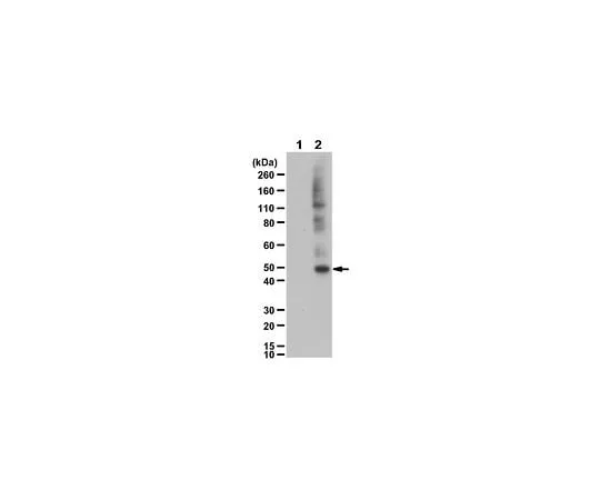 62-8474-03 Anti-phospho-Keratin-18 Antibody (Ser52) ABT1383