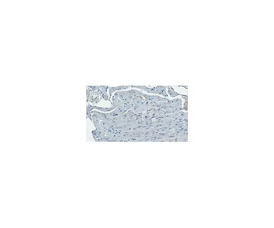 62-8503-80 Anti-iASPP Antibody, clone LX128. MABC1166