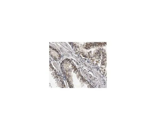 62-8473-61 Anti-LTBP-3 ABT316