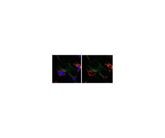 62-8472-49 Anti-Ena/VASP-like protein; 100 μg ABT63