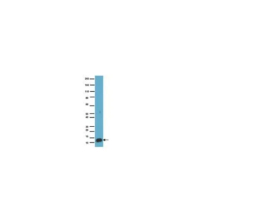 62-8488-37 Anti-S-100 Protein, clone 15E2E2; 100 μL MAB079-1