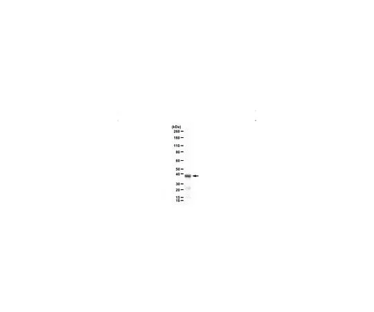 62-8468-88 Anti-SET-beta Antibody ABN1738