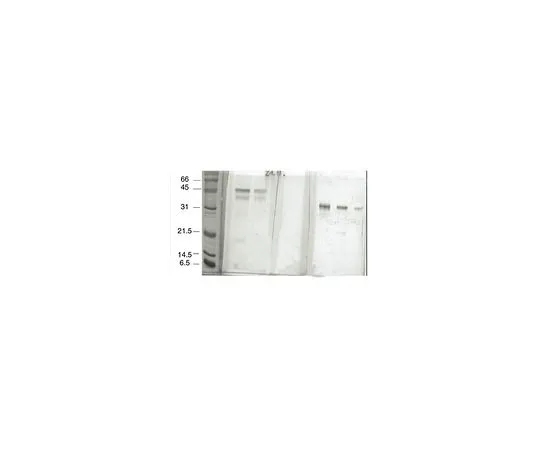 62-8497-61 Anti-RAGE, clone DD/A11 or mAbA11; 100 μg MAB5328